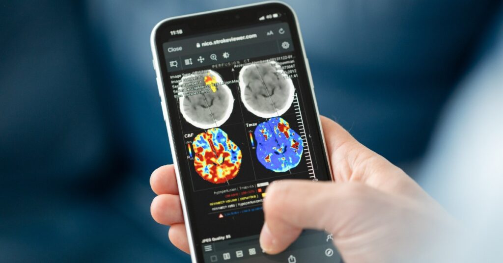Nicolab StrokeViewer mobile app