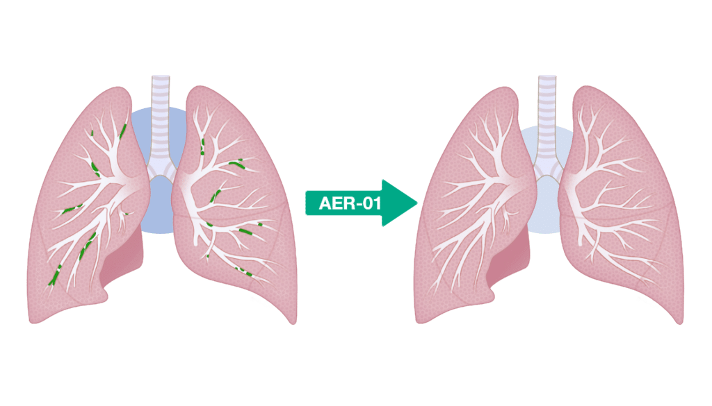 AER-01