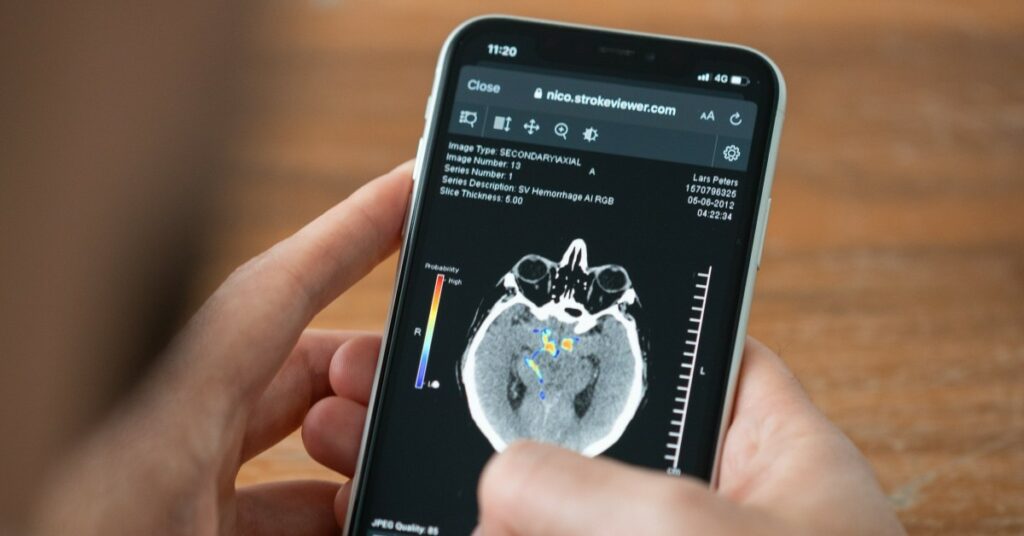 Nicolab strokeviewer mobile