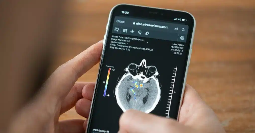 Nicolab strokeviewer mobile
