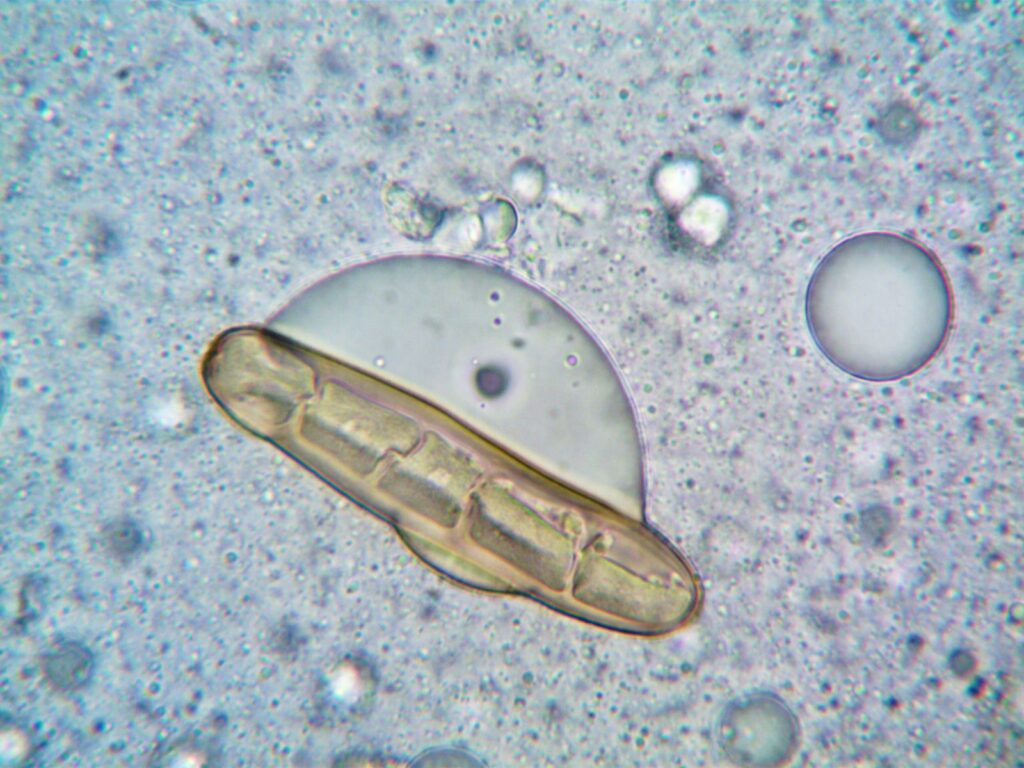 Tardigrades can survive being boiled, frozen to near absolute zero, and shot into the vacuum of space, and they do it by replacing the water in their cells with a glass-like sugar that suspends their biology until conditions improve